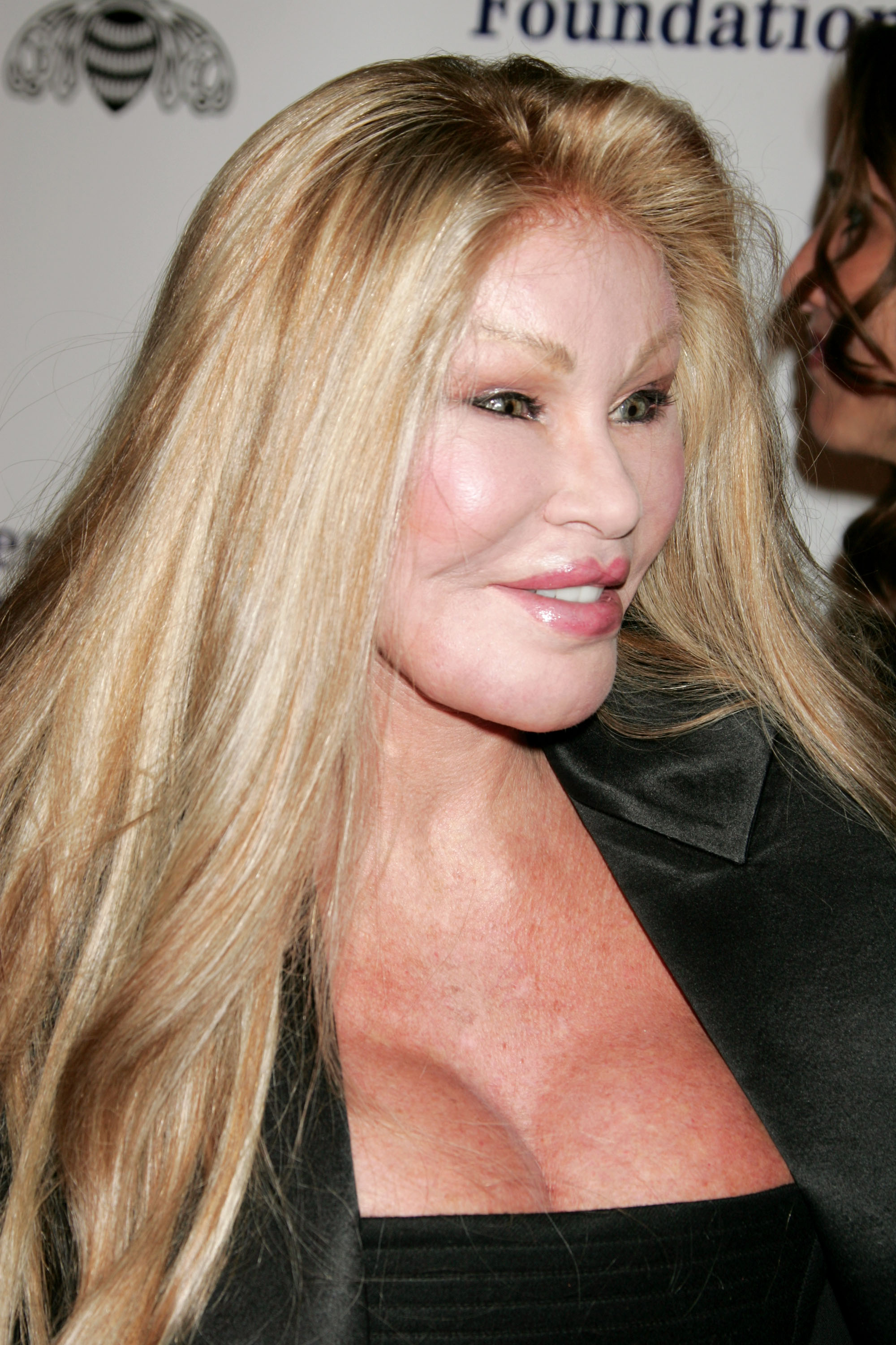 Jocelyne Wildenstein appeared with an extremely pulled mid-face and a tight hairline above a smooth forehead, while arriving at Children Uniting Nations' 9th Annual Awards celebration and viewing dinner on February 24, 2008, at the Beverly Hilton hotel in Beverly Hills, California.
