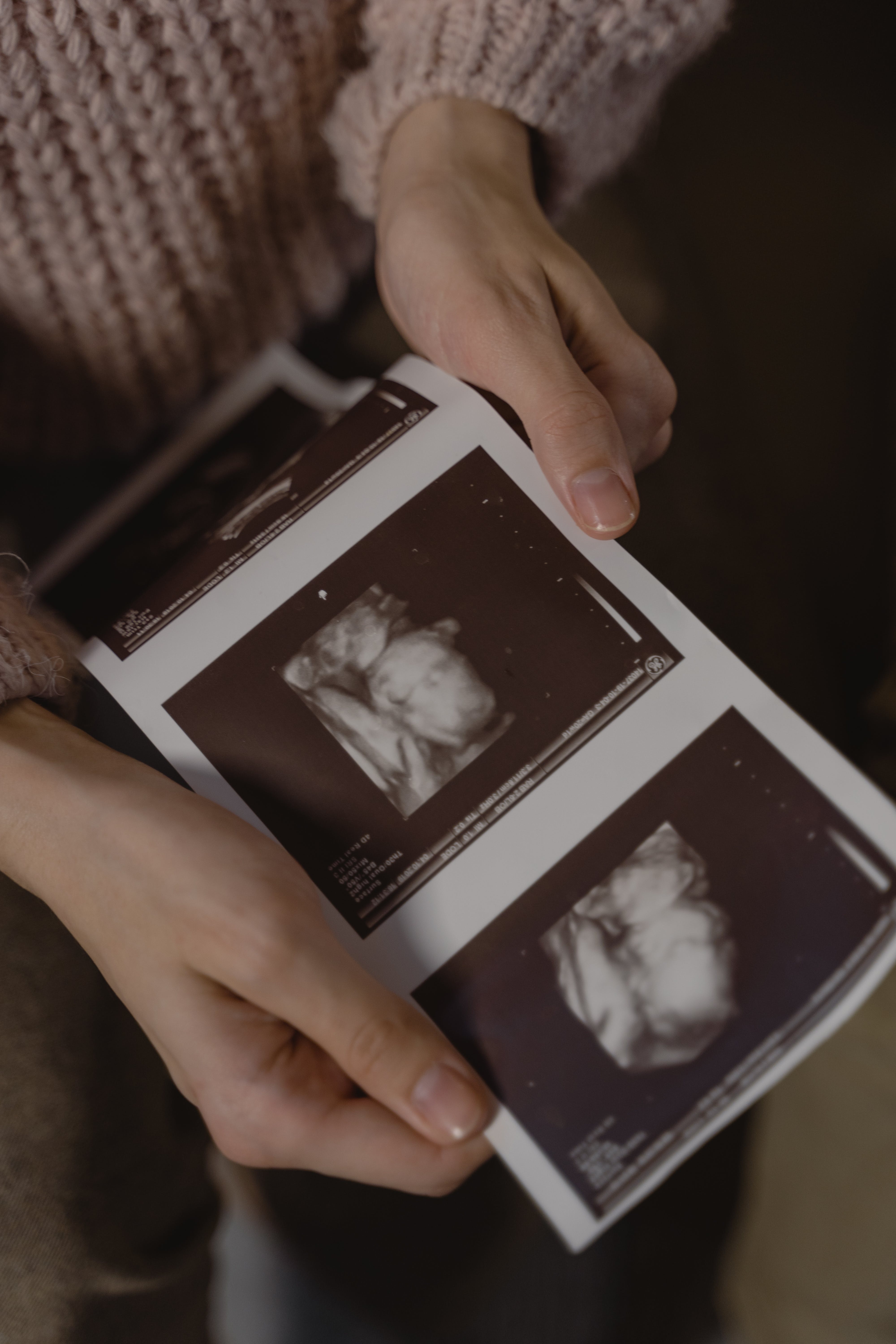 Ultrasound | Source: Pexels