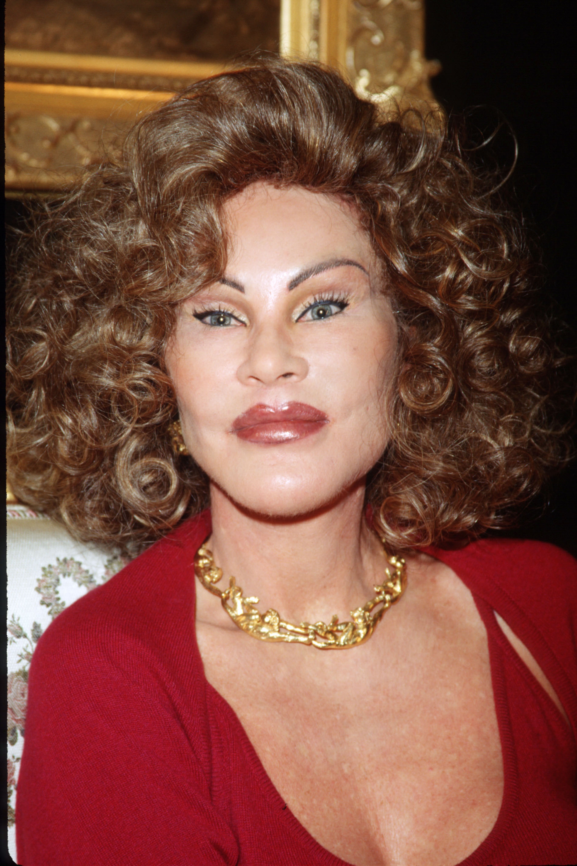 Jocelyne Wildenstein's features were marked by an unnatural smoothness across her forehead, lips noticeably plumped and heavily lined with gloss, deeply recessed eyes set beneath dramatically lifted brows, and a shadowed area below her angular cheekbones, as she posed for a picture on February 10, 1999, in New York City.