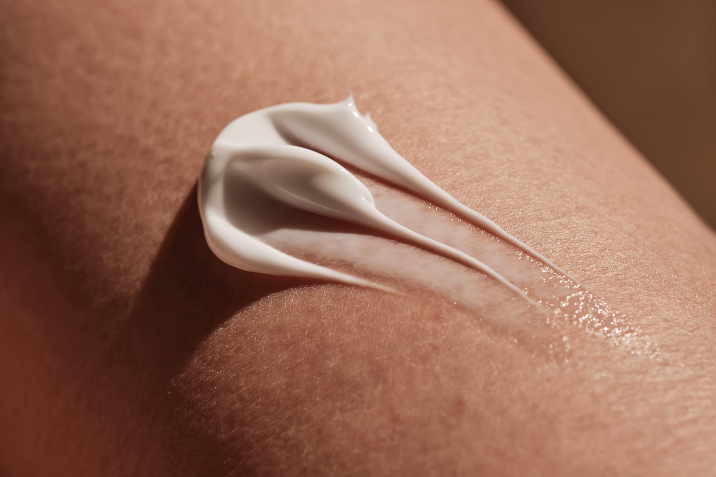 A dollop of sunscreen on skin | Source: Getty Images